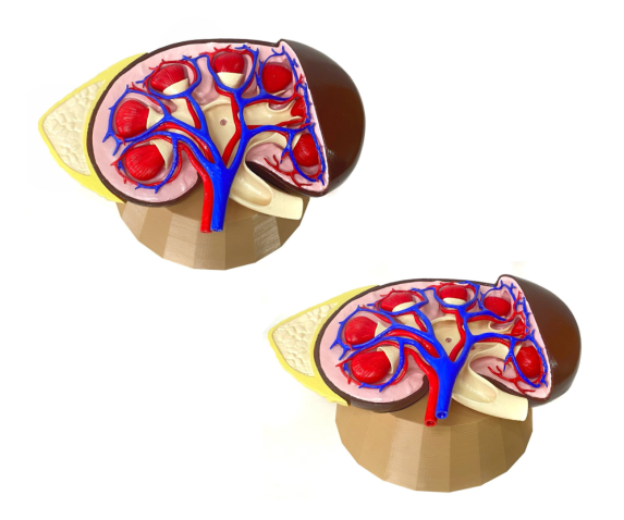 Обʼємна модель. Нирка людини