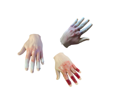 Імітатори обморожень пальців кисті руки 1-го,...