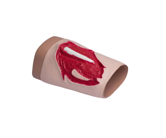 Муляж травми кінцівки з ушкодженням кістки