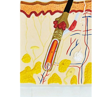 Барельєфна модель. Будова шкіри людини тип 1