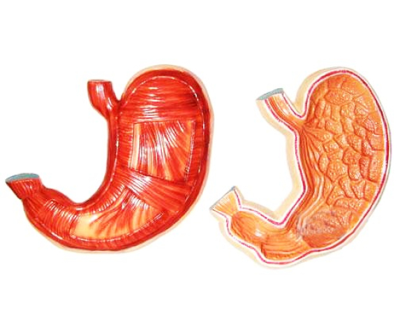 Барельєфна модель. Будова шлунку людини тип 1